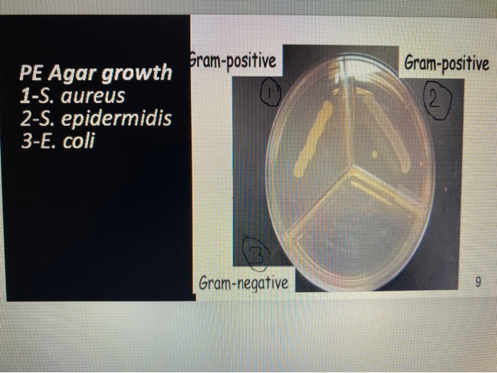 <p>Selects for Gram-positive organisms.</p>