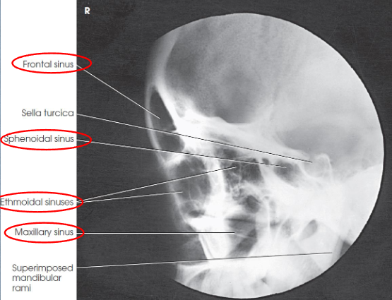 <ul><li><p>demonstrates:</p><ul><li><p>all four sets of sinuses</p></li><li><p>anteroposterior (AP) and superoinferior dimensions of paranasal sinuses</p></li><li><p>thickness of frontal bone</p></li><li><p>detail of side closer to IR</p></li></ul></li><li><p>sphenoidal sinus best demonstrated</p></li><li><p>no rotation or tilt</p><ul><li><p>sella turcica in profile</p></li><li><p>superimposed orbital roofs</p></li><li><p>superimposed mandibular rami</p></li></ul></li><li><p>air-fluid levels, if present</p></li></ul><p></p>