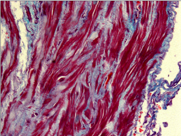 <p>Where is this epithelium</p>