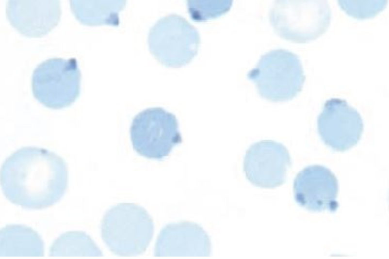 <p>what is this an example of (*hint: in supravital stain)?</p>