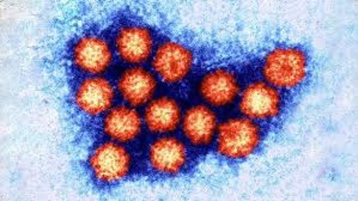 <p>Identify Pathogen causing Diarrhea:</p><p>ssRNA virus in Caliciviridae family</p><p>&gt; MCC of Gastroenteritis in developed countries</p><p>&gt; MCC of Water Diarrhea in adults &amp; Rotavirus-vaccinated children</p><p>-Hx:</p><p>&gt; Local outbreaks from contaminated seafood</p><p>&gt; Cruise ships</p><p>&gt; Business Conferences</p><p>-Path: Illness develops 12 to 48 hrs after contaminated food or water is ingested</p><p>-Sx/PE:</p><p>&gt; May be Asx</p><p>&gt; Watery Diarrhea (x2-3 days)</p><p>&gt; N/V</p><p>-Dx:</p><p>&gt; (-) Fecal Smear</p><p>-Tx: Self-Limiting</p>