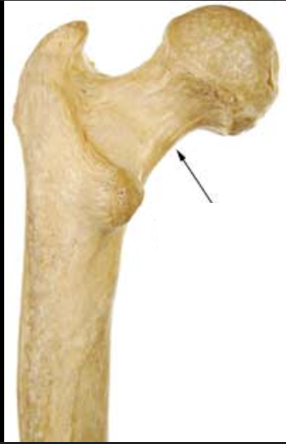 <p>the thinner, connector of the head to the long bone</p>