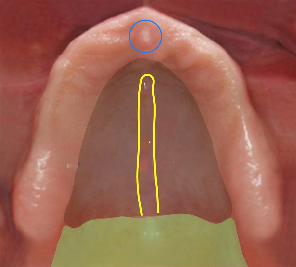 <p>what structure is circled in blue?</p>