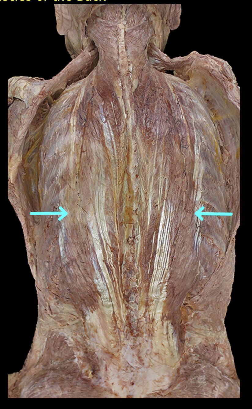 <p>Structure? What type of muscle is this?</p>