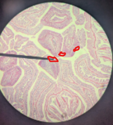 <p>the thick radial partionins divding the gastrovascular cavity into chambers </p>