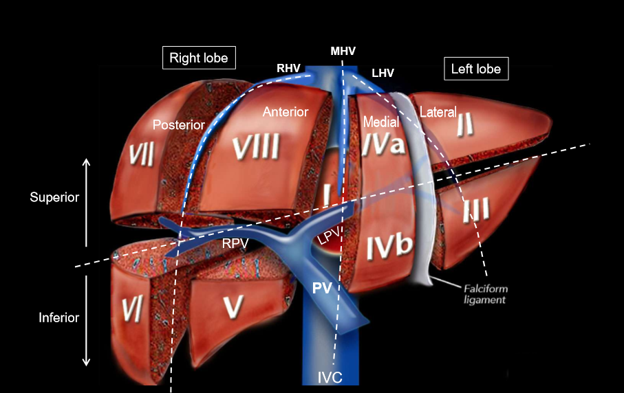 <p>on this illustratiom, it looks like the medial part of the left lobe is seperated from the lateral part by the falciform ligament. How is actually seperated?</p>