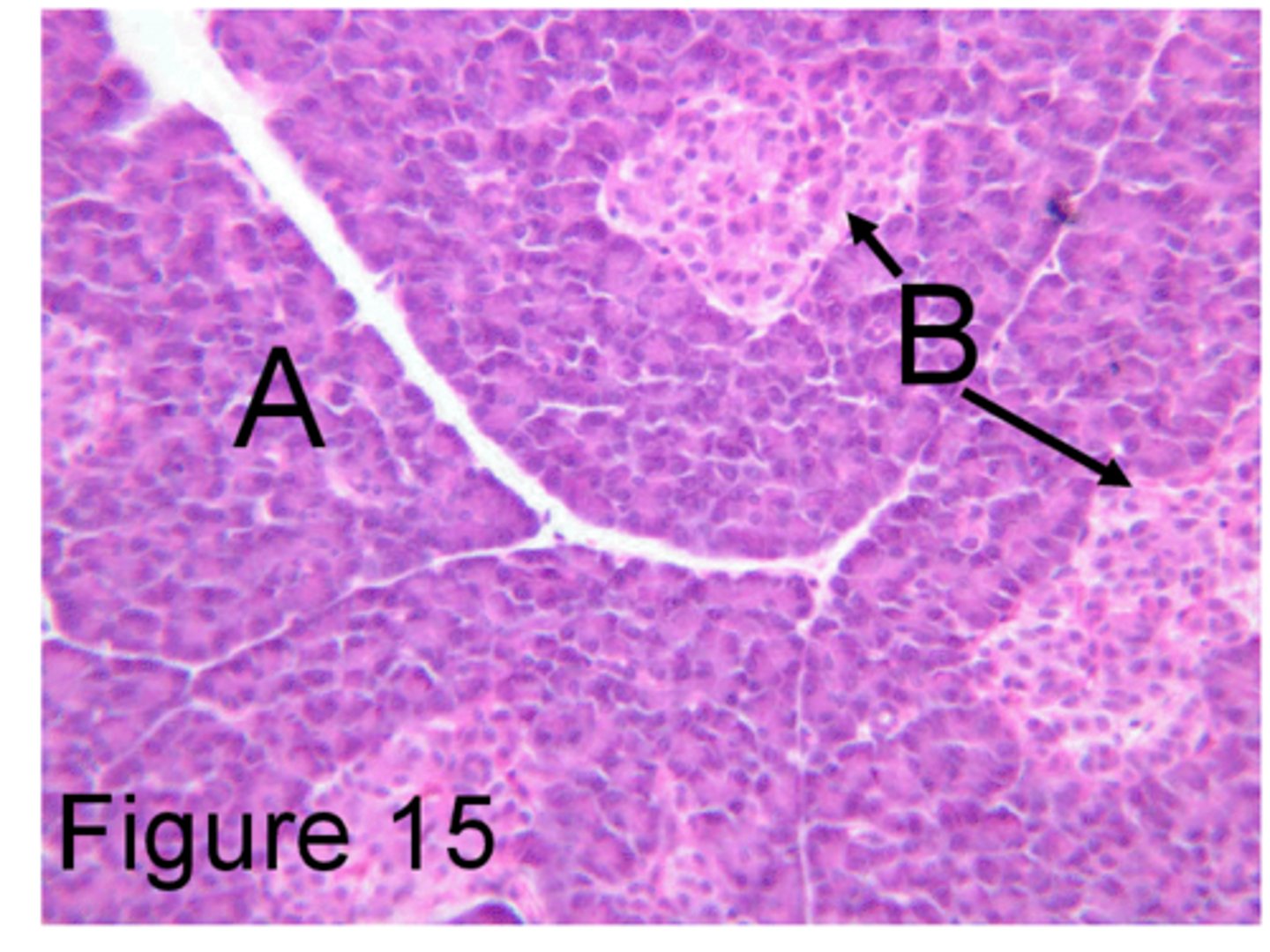 <p>A</p><p>Synthesizes and secretes digestive proenzymes and enzymes</p>