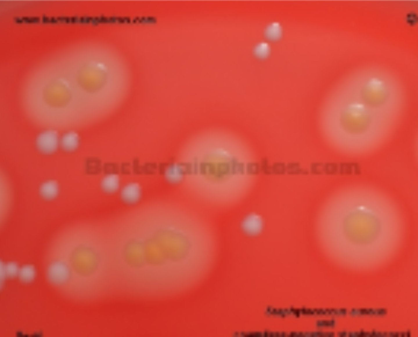 <p>hemolytic (RBC's are lysed, there is a halo around it) vs nonhemolytic bacteria (area around cells unchanged)</p>