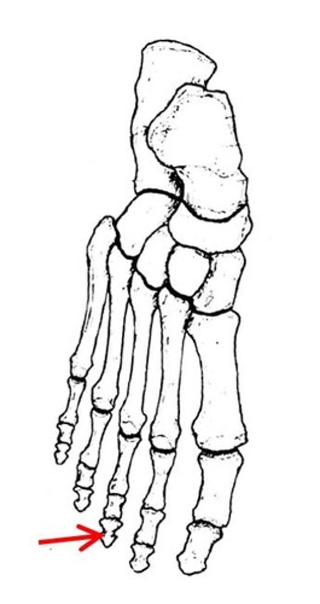 <p>ID specific bone</p>
