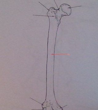 <p>This is a _____(right/left) femur. (State the bone)</p>