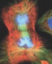 <p>What stage of mitosis?</p>