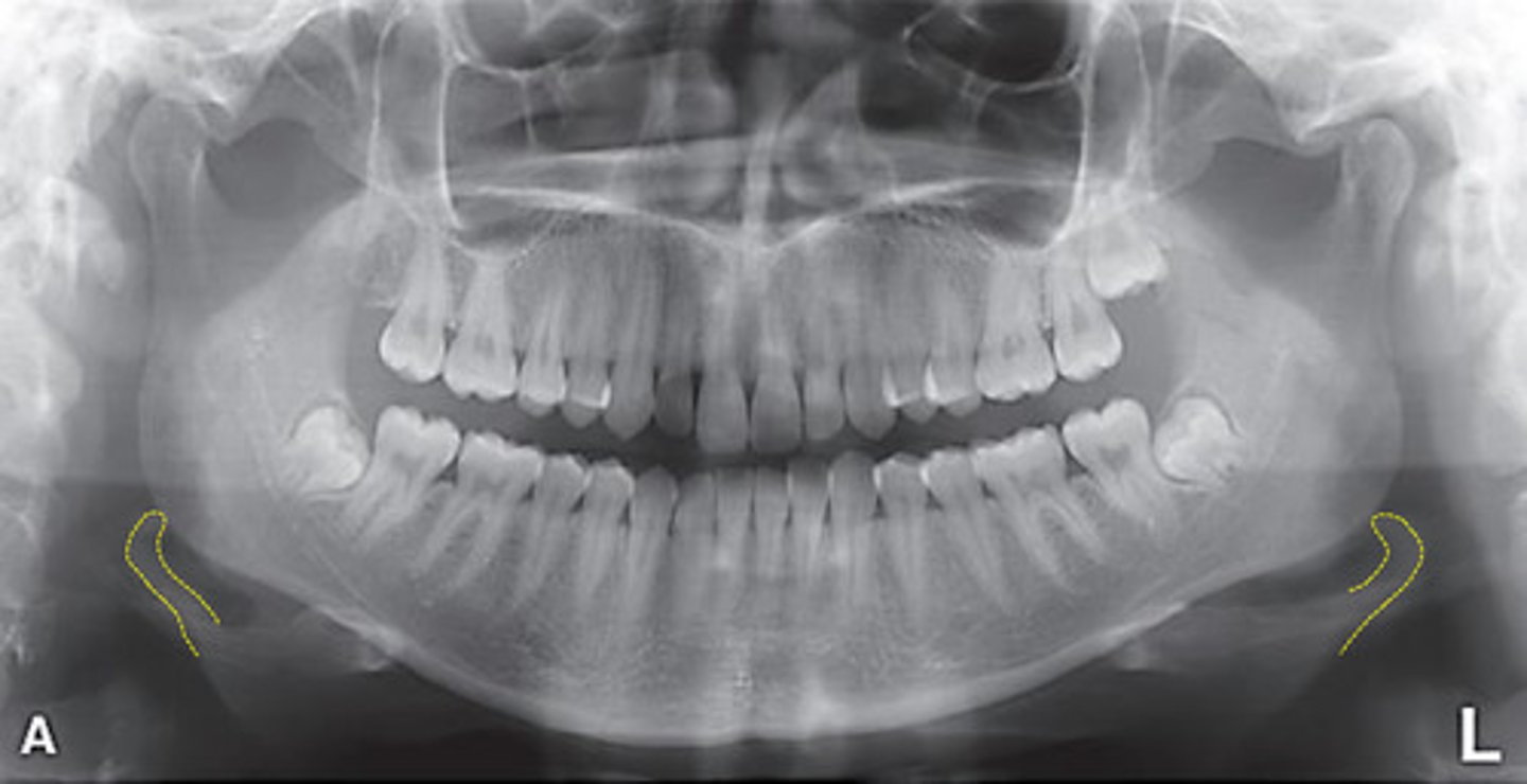 Radiography Anatomy Flashcards Knowt