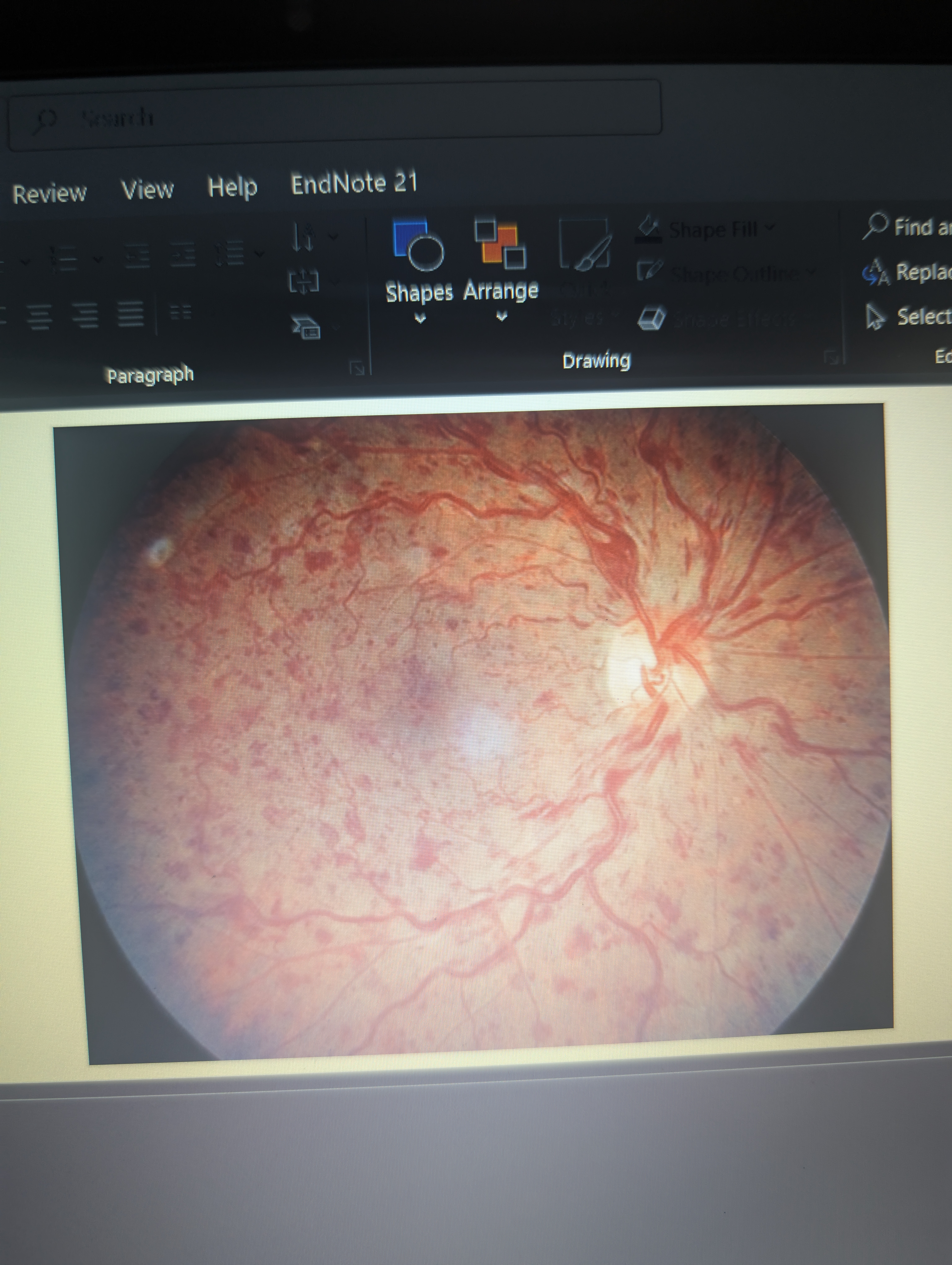 <p>What is this pathology?</p>