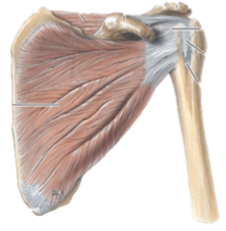 <p>What muscle is this?</p>