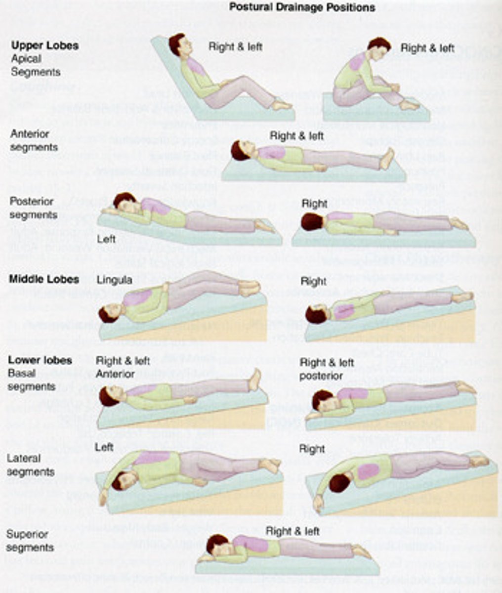 <p>A technique used to help clear mucus from the lungs by using gravity to assist in drainage</p>