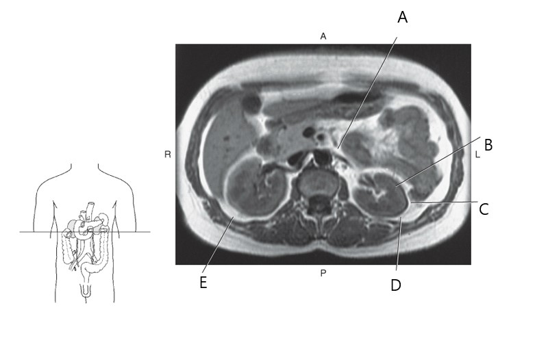 <p>anterior para renal space</p>