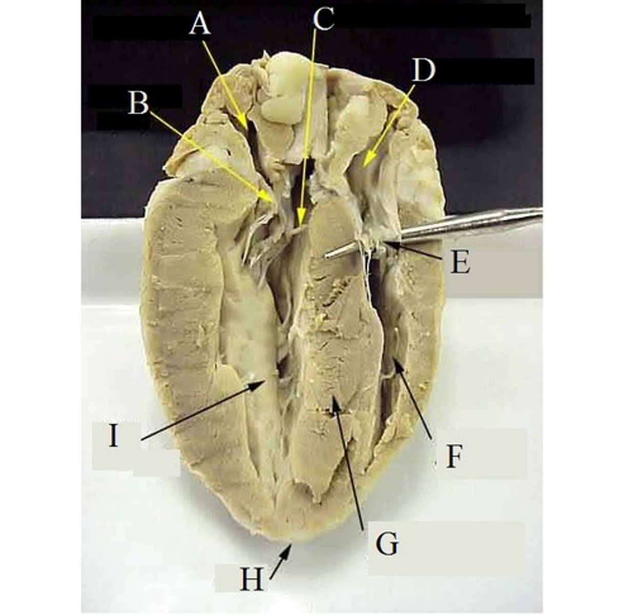 <p>A (Area)</p>