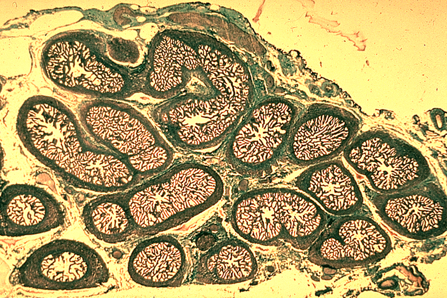 <p>Seminal vesicle</p><ul><li><p class=""><strong>Highly folded mucosa</strong>, giving a <strong>honeycomb</strong> or <strong>maze-like</strong> appearance. <strong>C-shaped appearance</strong></p></li></ul><p></p>