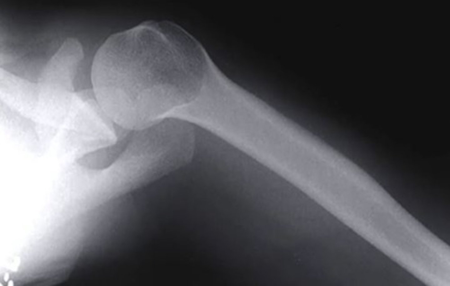 <p>axillary</p><p>3 multiple choice options</p>