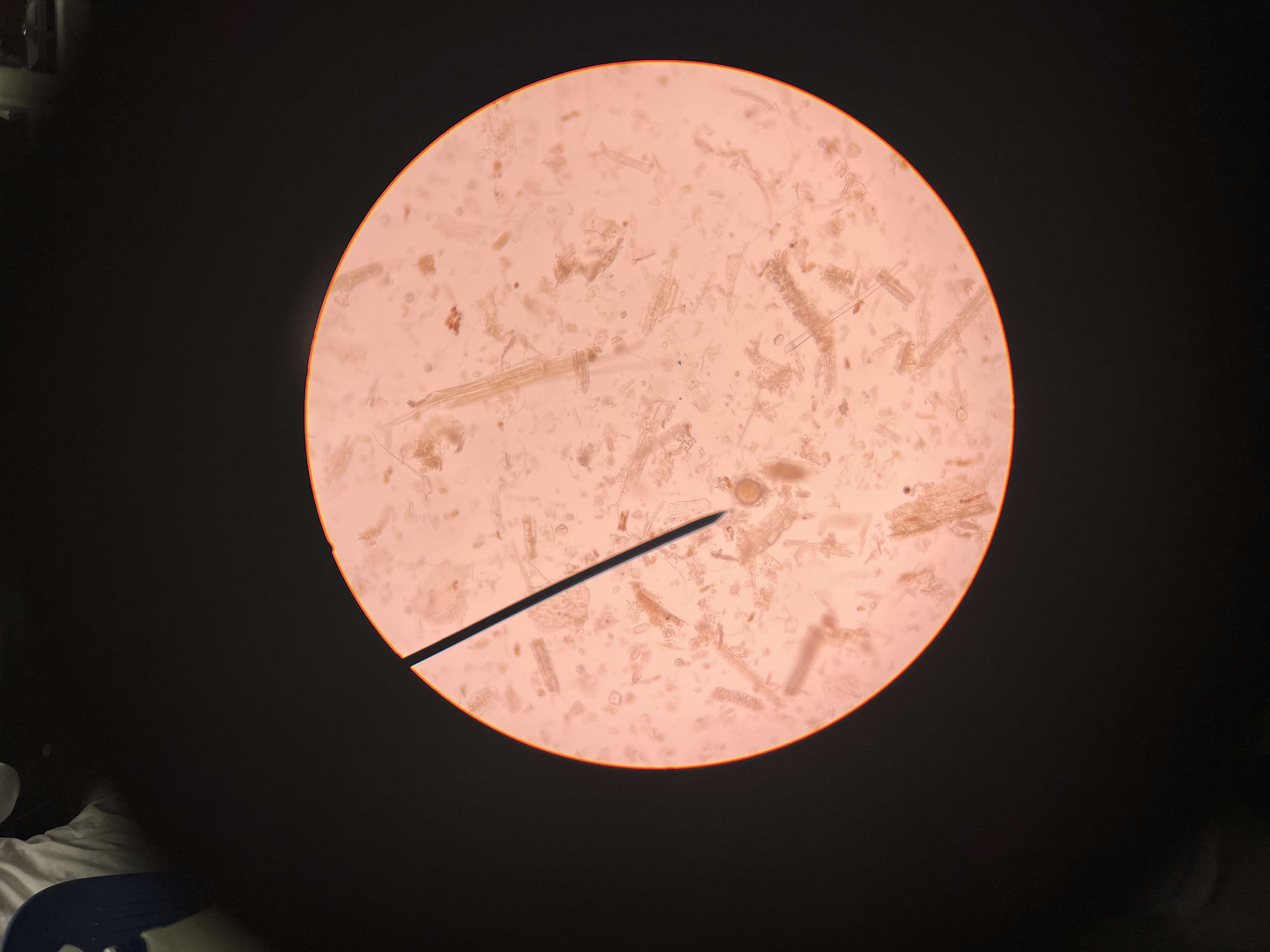 <p>Blood-feeding parasite eggs</p><p>Primary hosts are sheep and goats</p>