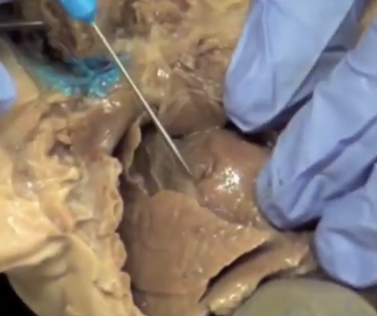 <p>What is the probe poking? (will go more in detail in week 3)</p>