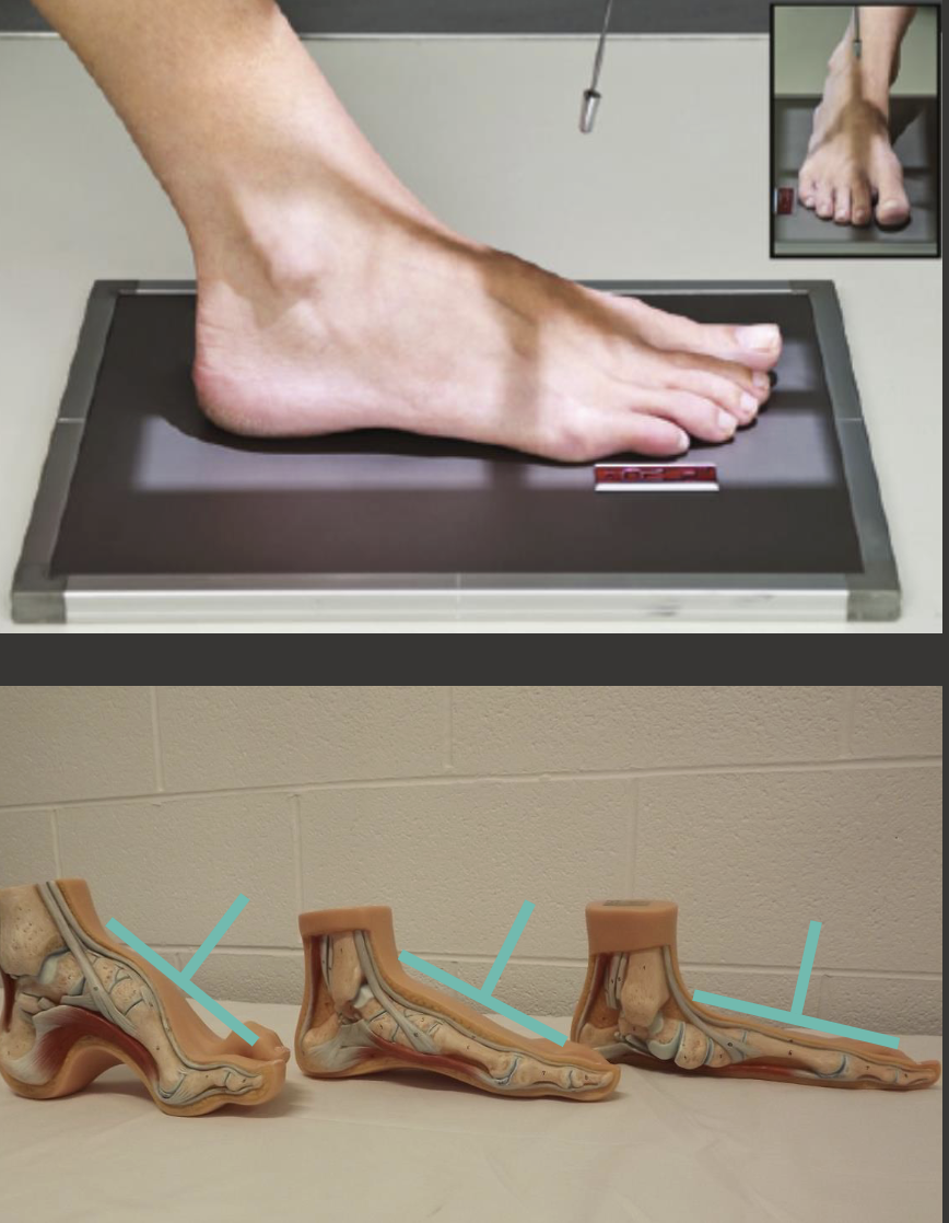 <p>Fine FS, 100cm</p><p>55kVp, 2.5mAs</p><p>Tube angle 5-15 degrees</p><p>CR: 3rd metatarsal base</p>