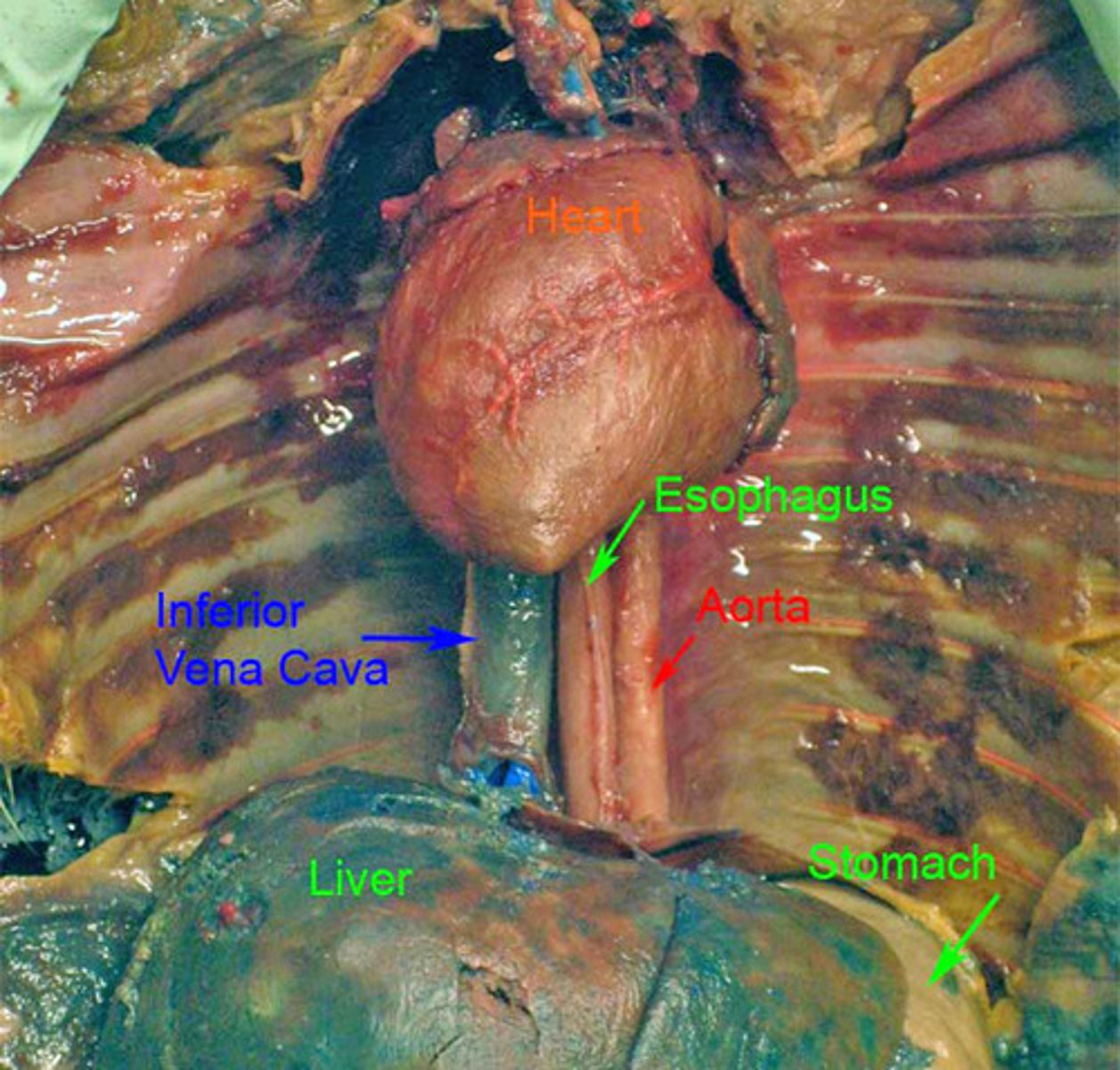 <p>Causes blood to flow through the body by its pumping action.</p>