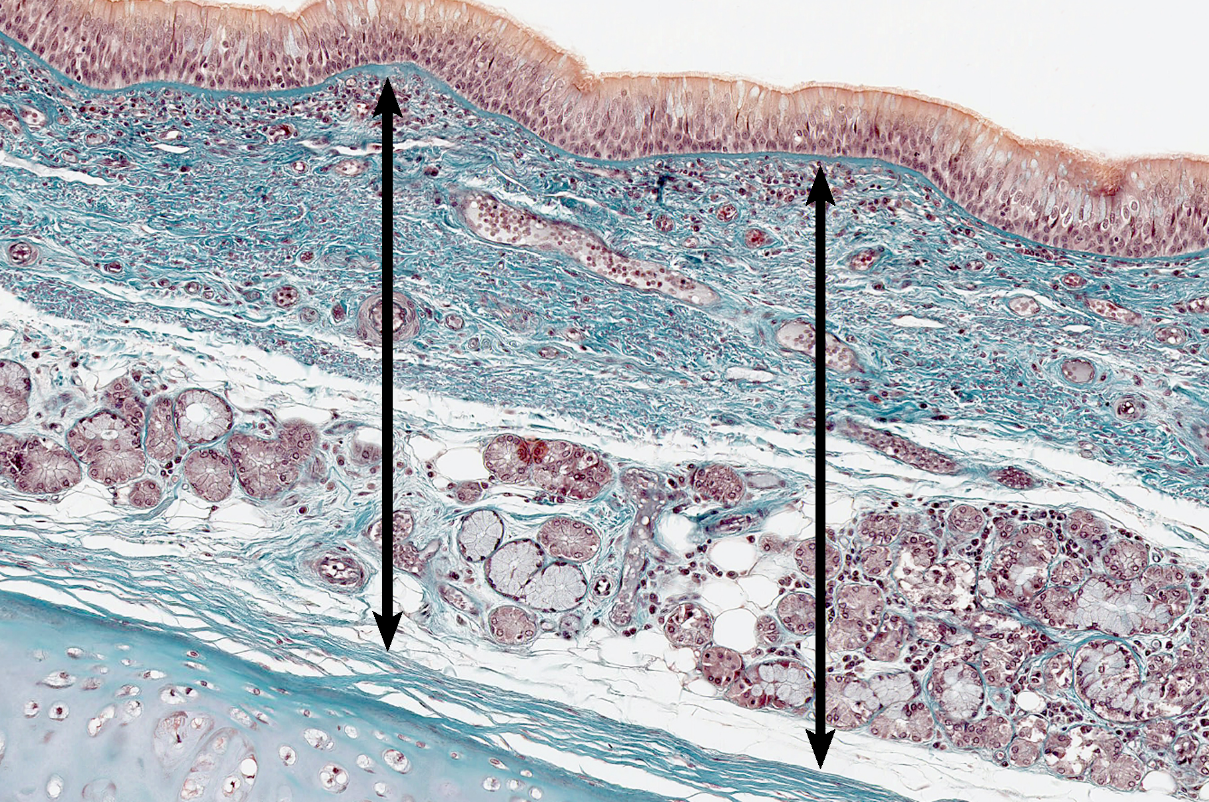 <p>histology, extends from the basement membrane to the perichondrium</p>