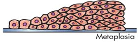 <p>reversible replacement of one mature cell type by another less mature cell type</p>