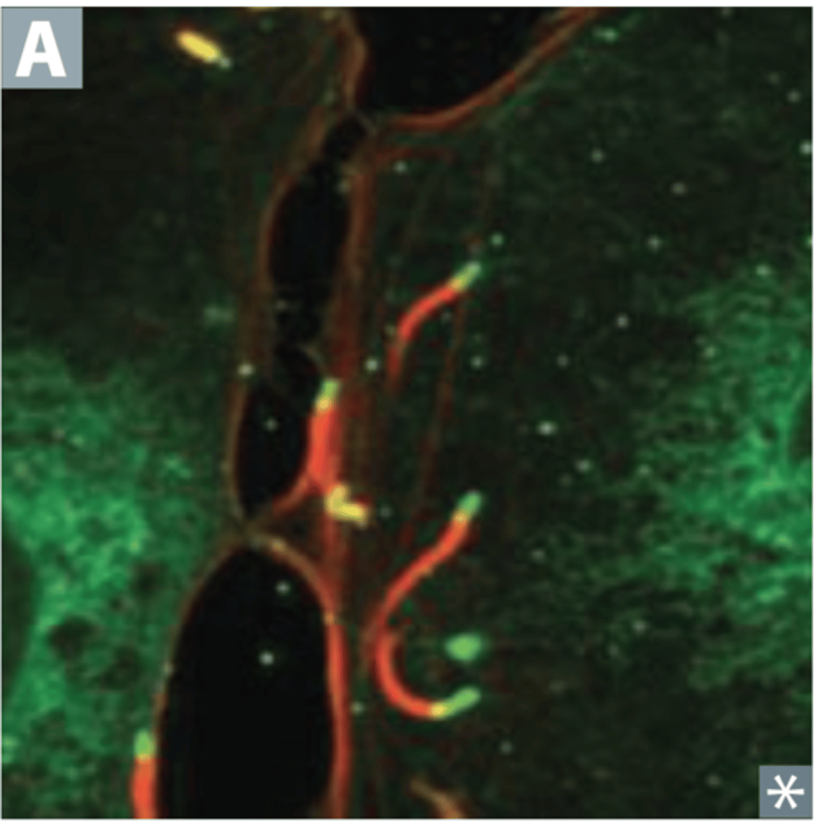 <p>Identify Pathogen causing Diarrhea:</p><p>Gram-positive, facultative intracellular rod - "tumbling motility"</p><p>-Hx:</p><p>&gt; Unpasteurized dairy products</p><p>&gt; Cold Deli meat/Hot Dogs</p><p>&gt; Vaginal transmission (delivery to neonate)</p><p>&gt; Multiplies in those with poor cell-mediated immunity </p><p>-Sx/PE:</p><p>&gt; Watery Diarrhea</p><p>&gt; Pregnant women =</p><p>&gt;&gt; Flu Sx</p><p>&gt;&gt; GI Sx</p><p>&gt;&gt; Spontaneous abortion (2nd or 3rd trimester)</p><p>&gt;&gt; Neonatal meningitis</p><p>&gt; Septiciemia</p><p>-Dx:</p><p>&gt; Grows well at refrigerated temps</p>