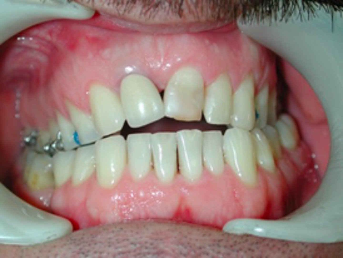 <p>ID the discrepancy:</p>