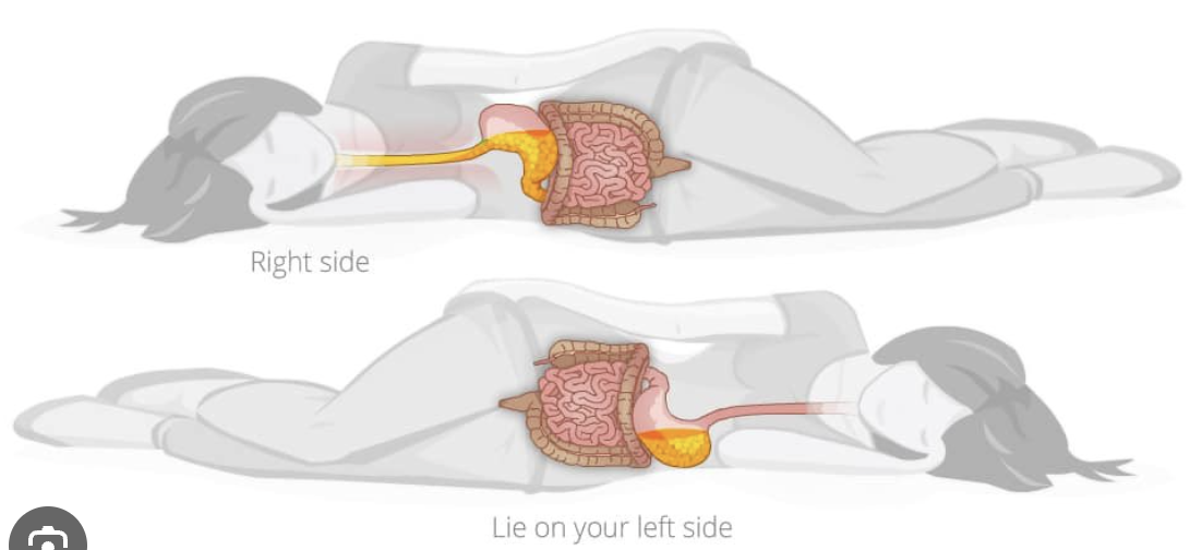 <p>due to the shape and curve of the esophagus into the stomach, the acid has a tendency to flow back up easier. here’s a picture to show this:</p><p></p>