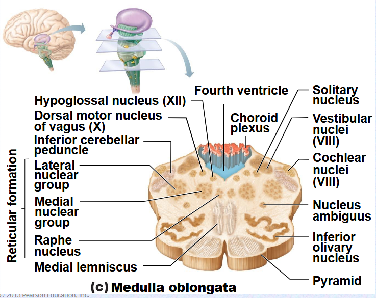 <p>(Decussation of Pyramids)&nbsp;</p><p>(Corticospinal tracts)&nbsp;</p>