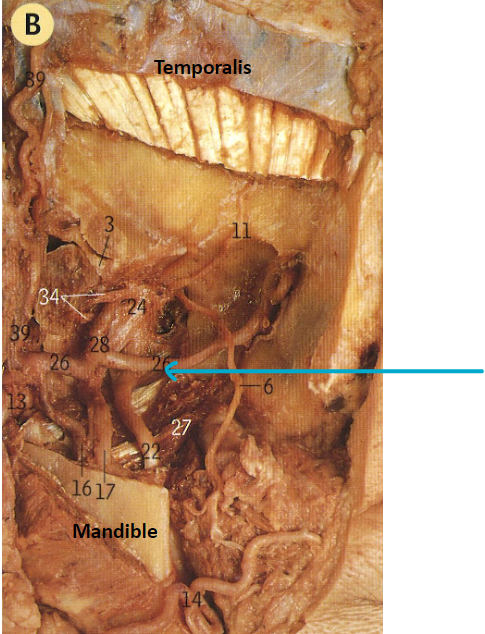 <p>what artery?</p>
