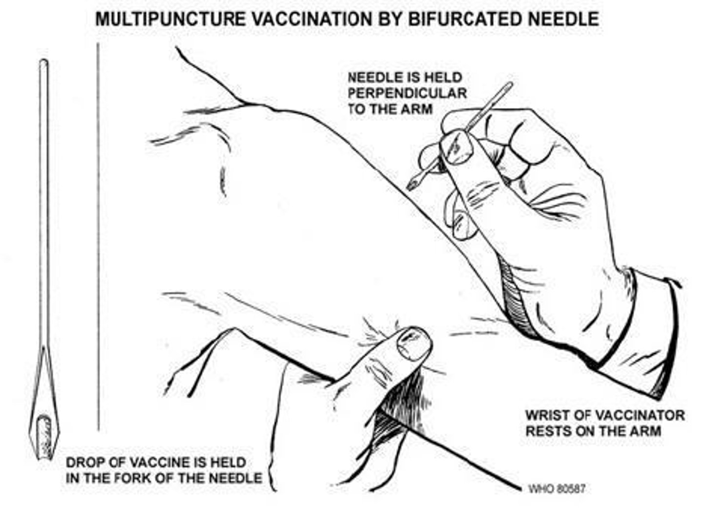 <p>To administer the smallpox vaccine.</p>