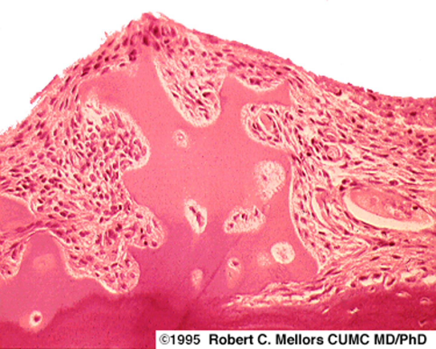 <p>identify the cartilage disease:</p>