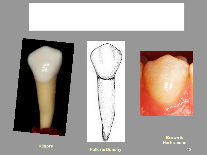 <p>From the Picture Shown, What Tooth Is This, And What View?</p>