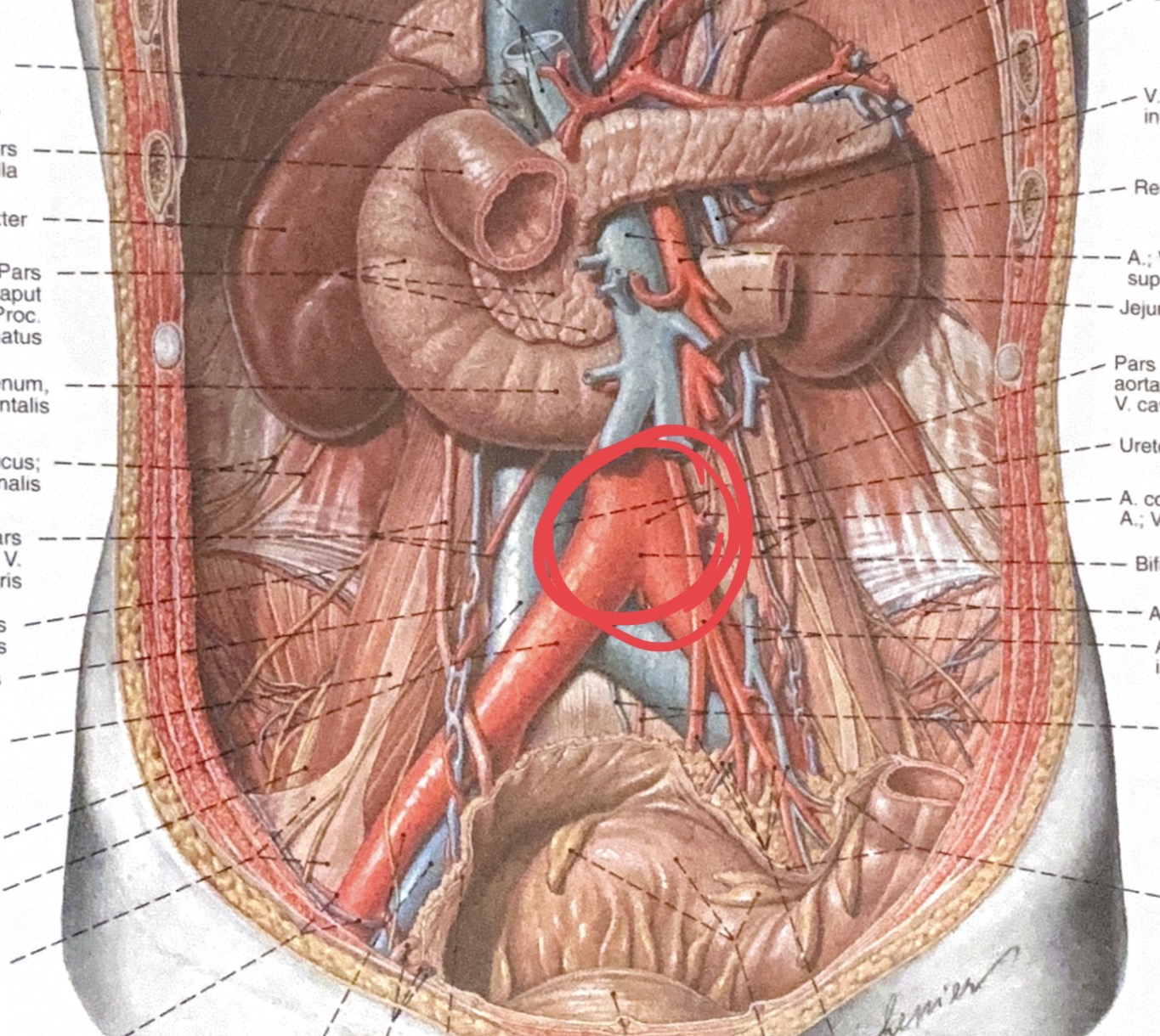 <p>bifurcatio aortae</p>