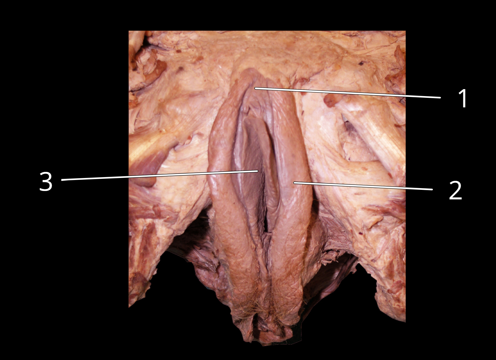 <p>Female external genitalia </p>