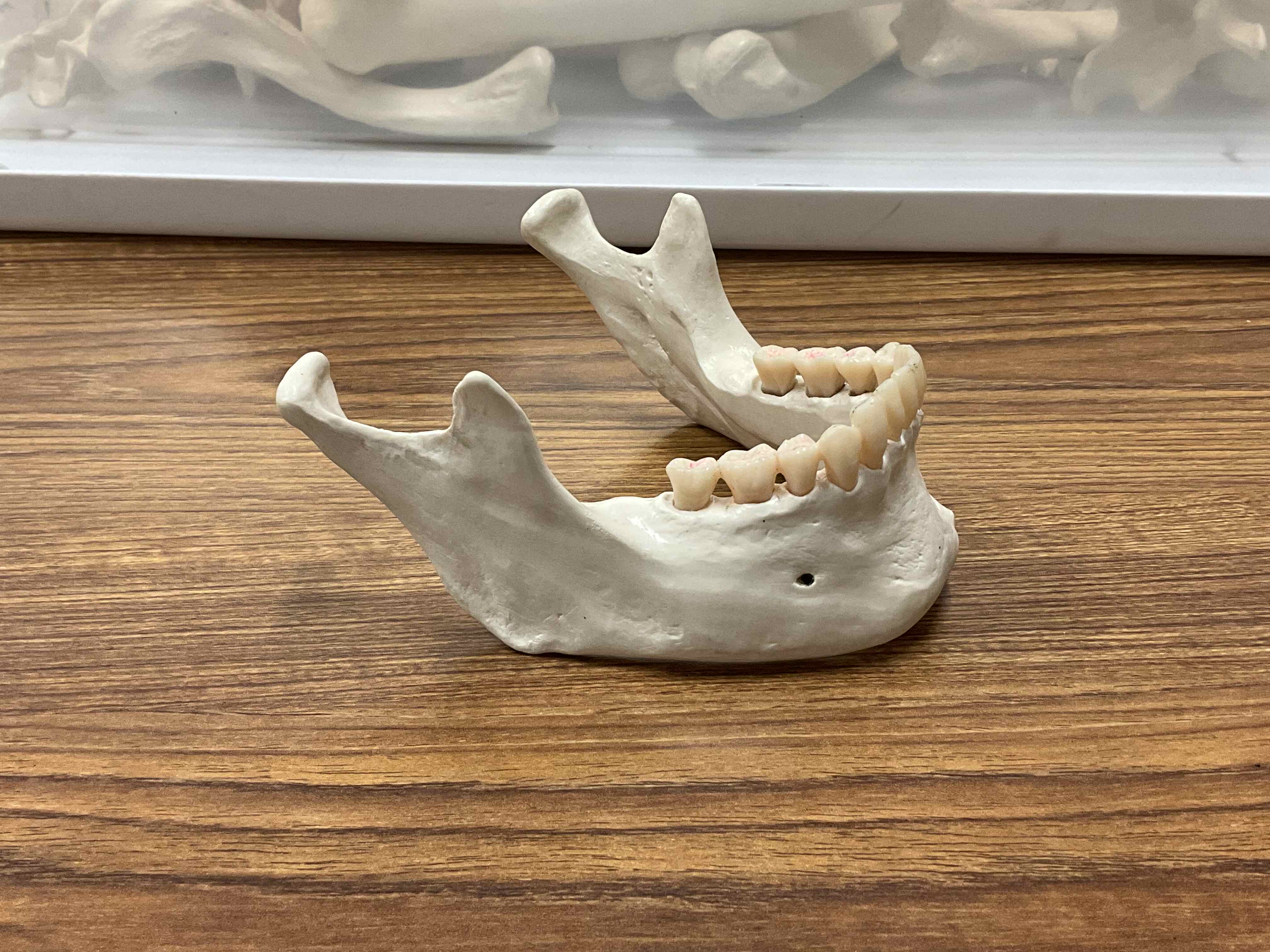 <p>Name the bone</p>