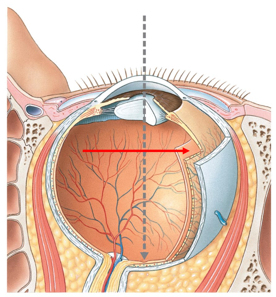 term image