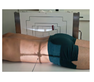 <p>What Position is this? ( Look how patient is with IR) </p><ul><li><p>Laying Prone with <strong>Horizontal</strong> beam </p></li></ul><p></p>