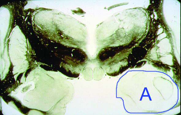 <p>What is structure “A”?</p>