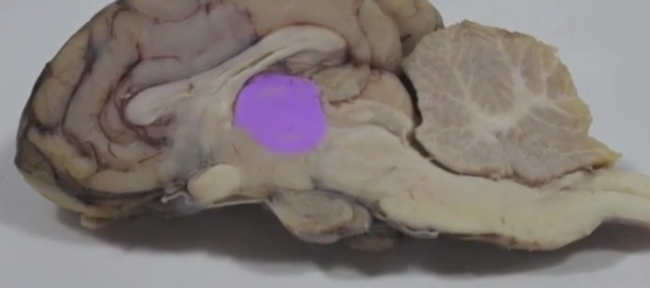 <p>Thalamus </p>