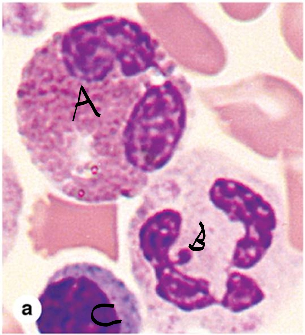 <p>A, B, C?</p>