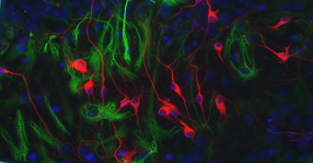 <p>What neurons are pictured?</p>
