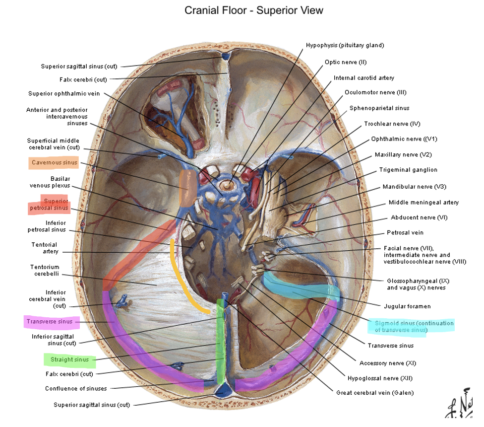 <p>superior petrosal ridge → transverse sinus → sigmoid sinus → internal jugular vein</p>