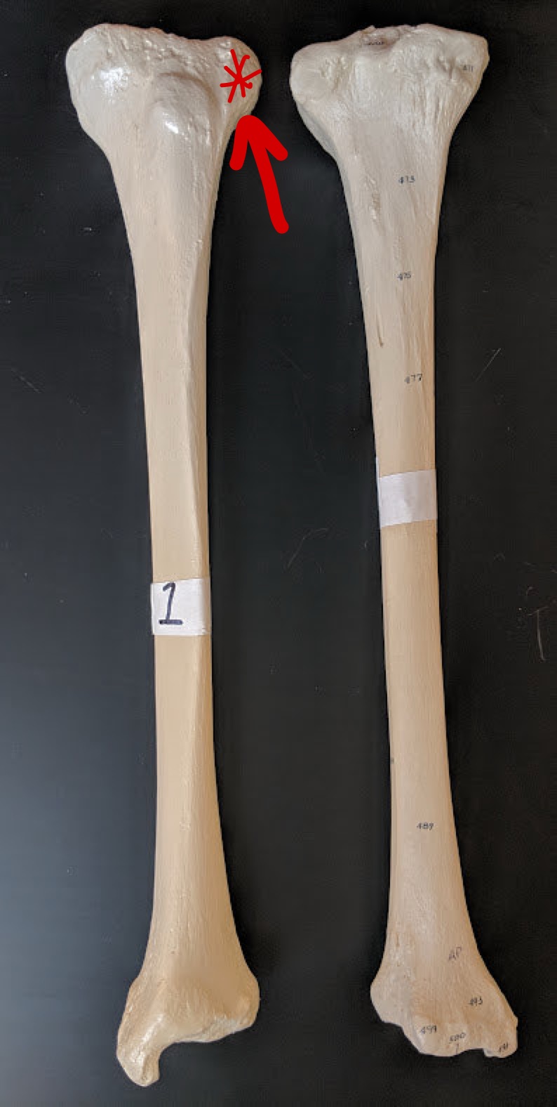 <p>Name this structure</p>