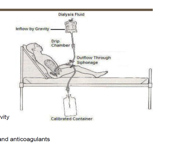 <ul><li><p>peritoneal dialysis</p><ul><li><p>solution infused into the peritoneal cavity</p></li><li><p>peritoneal membrane acts as dialyzer</p></li><li><p>for patients who are hemodynamically stable</p></li></ul></li><li><p>peritoneal physiology</p><ul><li><p>contains ~10 mL liquid</p></li><li><p>can expand to hold several liters</p></li><li><p>surface area of 1-2 m<sup>2</sup></p></li><li><p>allows passage of <strong>larger MW </strong>substances</p></li><li><p>catheters = used to gain access to peritoneal cavity</p></li></ul></li><li><p>dialysate</p><ul><li><p>high <strong>dextrose solution</strong> containing various solutes and anticoagulants</p></li></ul></li></ul><p></p>