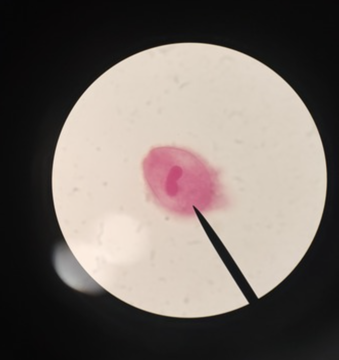 <ul><li><p>identify</p></li><li><p>m.o.t</p></li><li><p>infective stage</p></li><li><p>host</p></li></ul><p></p>